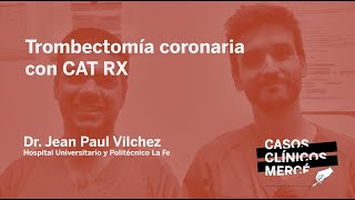 Caso Clínico Mercé 65 TROMBECTOMÍA coronaria con CAT RX Hospital Universitario La Fe [upl. by Siegfried]