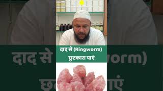 Asaan Tarike Se Daad Ko Khatam Karen ringworm shorts healthtips [upl. by Vicky]