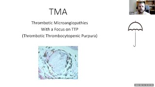 Thrombotic Microangiopathies with a Focus on TTP Thrombotic Thrombocytopenic Purpura [upl. by Idak]