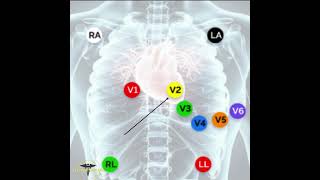 ECG PLACEMENT  12 LEAD ECG [upl. by Ettenauq]