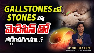 Treatment options for gallstones telugu  Gallstone SURGERY  Dr Mustafa Surgical Gastroenterology [upl. by Nymsaj]