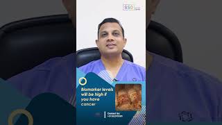 Biomarkers for Ovarian Cancer CA125 Vs HE4 Explained  Ovarian Cancer Diagnosis  Dr Nilesh [upl. by Oiruam]