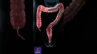 Colonoscopy Procedure Shorts colonoscopy [upl. by Ardyaf]