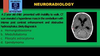 Medulloblastoma II CTMRI findings [upl. by Leviram]