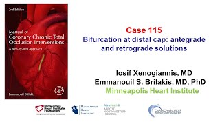 Case 115 Manual of CTO Interventions  Bifurcation at distal cap and retrograde crossing [upl. by Elizabeth162]