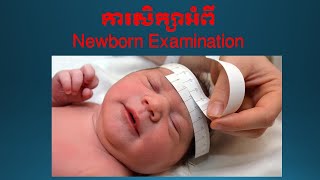 Newborn Examination [upl. by Schiffman845]