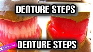 Denture Steps Bite Blocks and Bite Registration [upl. by Nikaniki]