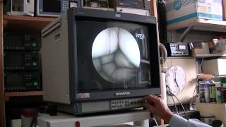 demonstration colonne video Fjinon EPX 201 et EG 200 gastroscope [upl. by Shirlie]