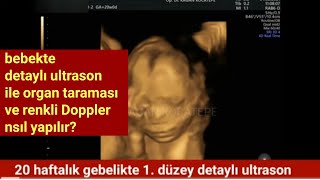 20 gebelik haftasında 1 düzey detaylı ultrason ile organ taraması ve renkli Doppler nasıl yapılır [upl. by Surat]