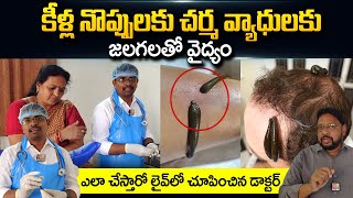 DrShanti Swaroop About Leech Treatment  Knee Pains  Leech Therapy for Skin  SumanTV Telugu [upl. by Urbas]