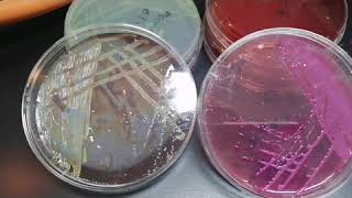 كيفية عزل البكتيريا streaking of bacteria plate methods [upl. by Nus]