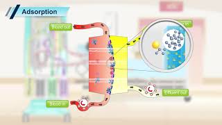 Prismaflex CRRT Transport Mechanism [upl. by Yrtsed]