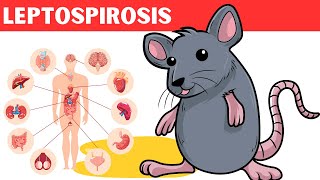 Leptospirosis  Causes Risk Factors Pathology Signs amp Symptoms Diagnosis And Treatment [upl. by Eilah]