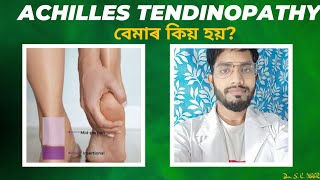 Achilles tendonitis Disease medical doctor [upl. by Anaynek802]