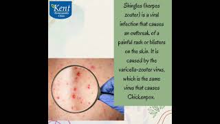 Shinglesherpes zostershinglesdrkukrejakalani8291492566kenthomeopathyclinichiranandanipowai [upl. by Maurine]