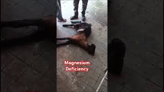 Hypomagnesemic Tetany  Magnesium Deficiency [upl. by Nitsa]