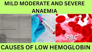 LOW HBHEMOGLOBINCAUSES SYMPTOMSCLASSIFICATION OF ANEMIAMILD MODERATE AND SEVERE ANAEMIA [upl. by Pulchia]