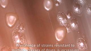 Streptococcus pneumoniae [upl. by Yramliw]