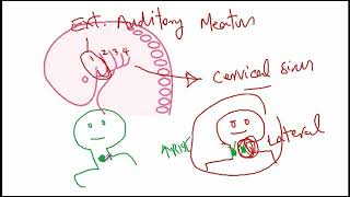 USMLE ACE Video 134 Thyroglossal Duct Cyst vs Branchial Cleft Cyst [upl. by Ennaitsirk]