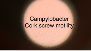 Campylobactercorkscrew motilityCampylobacter under a microscopeCampylobacter jejuni [upl. by Lednik]