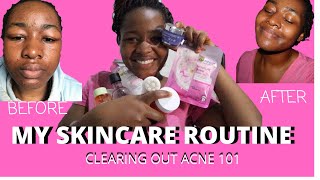 Skincare Routine  After the Duac Gel experience  Skincare [upl. by Charo999]