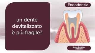 Endodonzia che cosè [upl. by Sanalda418]