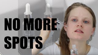 Kiehls Clearly Corrective Dark Spot Solution Review [upl. by Malik]