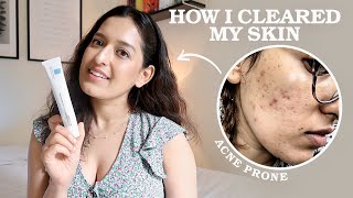 My 3 Step EvidenceBased Skincare Routine As A Doctor  HOW I CLEARED MY ACNE  Affordable Easy [upl. by Ennaira466]