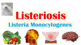 Listeriosis Listeria Monocytogenes  Sources Pathophysiology Symptoms Diagnosis Treatment [upl. by Oilla]