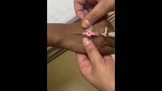 IV cannula insertiondoctortrendingshortsviralvideoyoutube [upl. by Noemad]