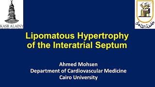 Lipomatous hypertrophy of the Interatrial Septum Lipomatous atrial septal hypertrophy LASH [upl. by Ayotas]