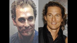 Matthew McConaughey  Hair Transplant [upl. by Bennion356]