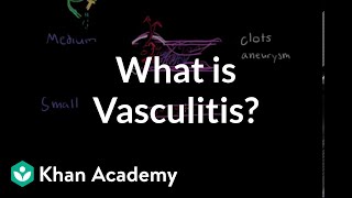 What is vasculitis  Circulatory System and Disease  NCLEXRN  Khan Academy [upl. by Anaiuq282]