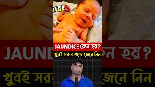 Jaundice কেন হয় Causes of Jaundice [upl. by Issy]