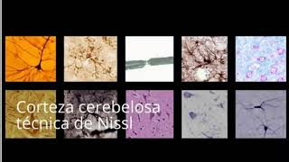 Histología NCR  P13  Corteza cerebelosa técnica de Nissl [upl. by Engelbert]