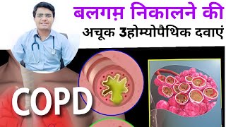 बलगम़ निकालने की अचूक दवा  balgam ki homeopathic medicine  balgam nikalne ki dawa  balgam nikalne [upl. by Myo]