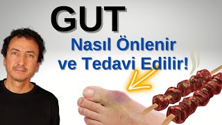 Gut Hakkındaki Gerçekler Nasıl Önlenir ve Tedavi Edilir [upl. by Wiburg908]