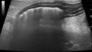 Ultrasonography of acute canine pancreatitis with associated colitis [upl. by Kcorb]