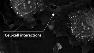 Cells in Action membrane protrusions in HUVECs Human Umbilical Vein Endothelial Cells [upl. by Lynn]