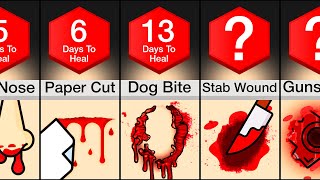 Comparison Fastest Healing Wounds [upl. by Zeralda668]