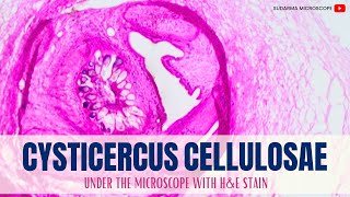 Cysticercus cellulosae under the microscope with Haematoxylin and Eosin HampE stain [upl. by Lorac779]