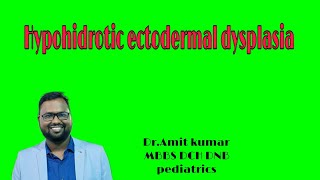 Hypohidrotic ectodermal dysplasia [upl. by Sandeep]