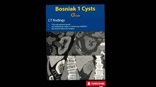 Bosniak 1 Cyst  CT  Radiology [upl. by Alage809]