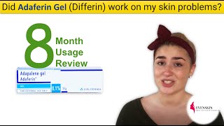 Adaferin Gel Differin 8 Months Use Review [upl. by Anilegna27]