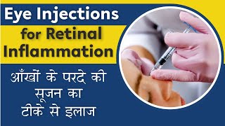 All about Eye Injections for Retina  Eye Cancer injection  आँखों के परदे की सूजन का टीके से इलाज [upl. by Einalem]