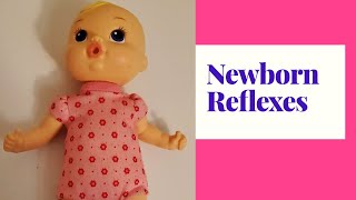 NEWBORN REFLEXES [upl. by Noicpesnoc]