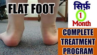 FLAT FEET TreatmentComplete Exercise PROGRAM To Correct Flat Feet OR FALLEN ARCHES [upl. by Nivrag539]