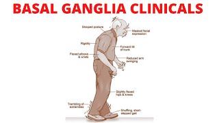 The Basal Ganglia Clinical Anatomy  Parkinson’s Disease  Chorea  Huntington Disease [upl. by Akinahc640]