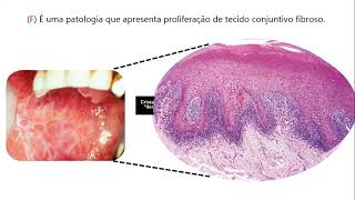 AULA DE PATOLOGIA PARA ITEPRN [upl. by Melentha]