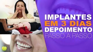 Implantes Dentários Boca Toda em 3 Dias  Depoimento Passo a Passo [upl. by Lehmann]